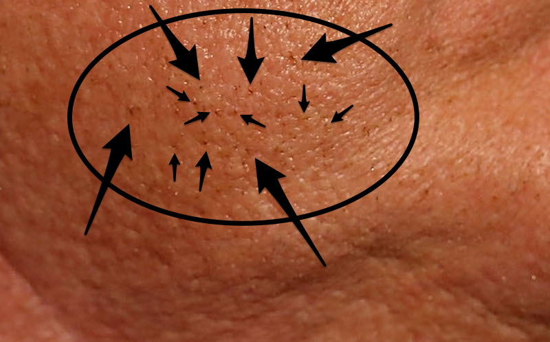 Illustration for article titled Can Donald Trump Grow A Beard? An Investigation